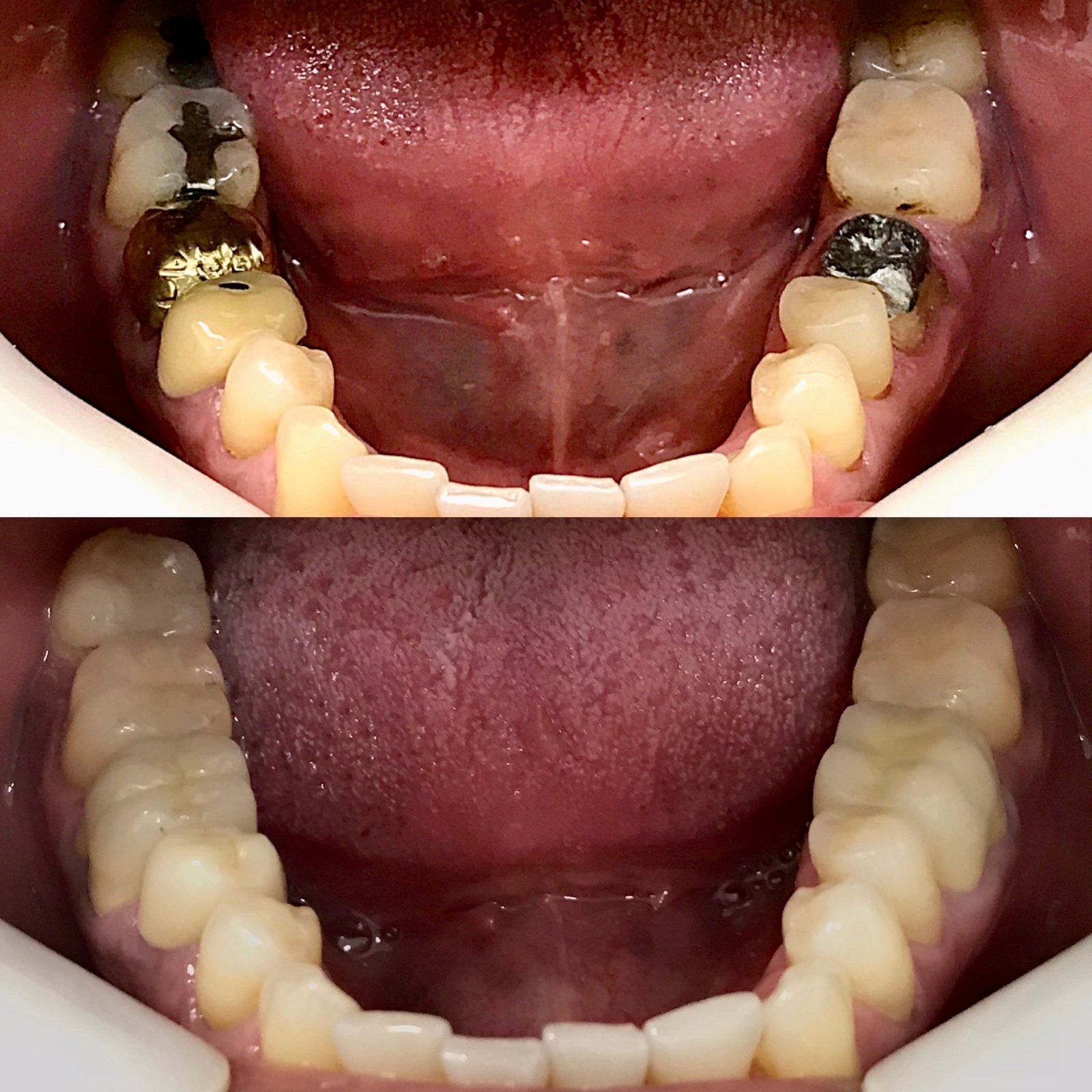 F453F065-3EDF-4C54-B904-3E7D6C2C89FC (1)